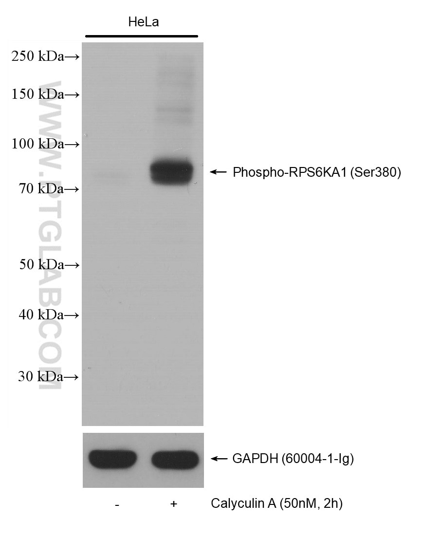 Western Blot (WB) analysis of various lysates using Phospho-RPS6KA1 (Ser380) Recombinant antibody (80108-1-RR)