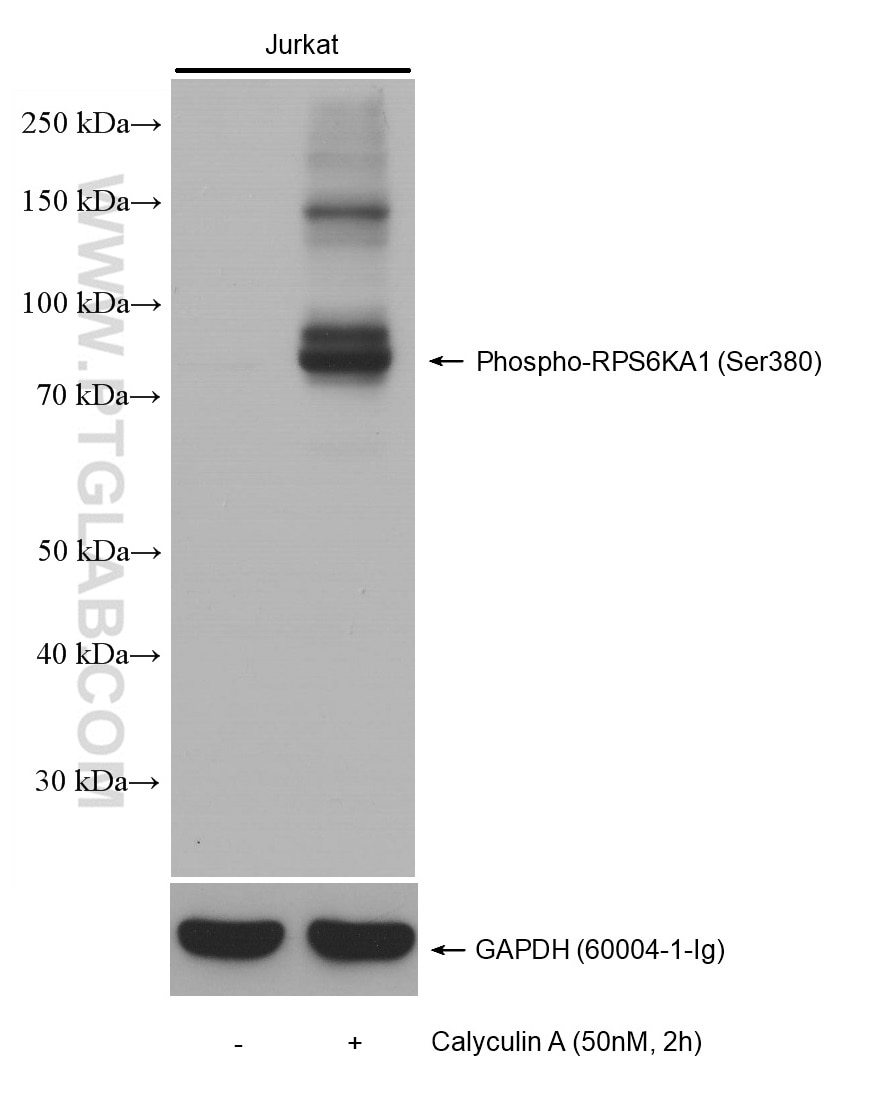 Western Blot (WB) analysis of various lysates using Phospho-RPS6KA1 (Ser380) Recombinant antibody (80108-1-RR)