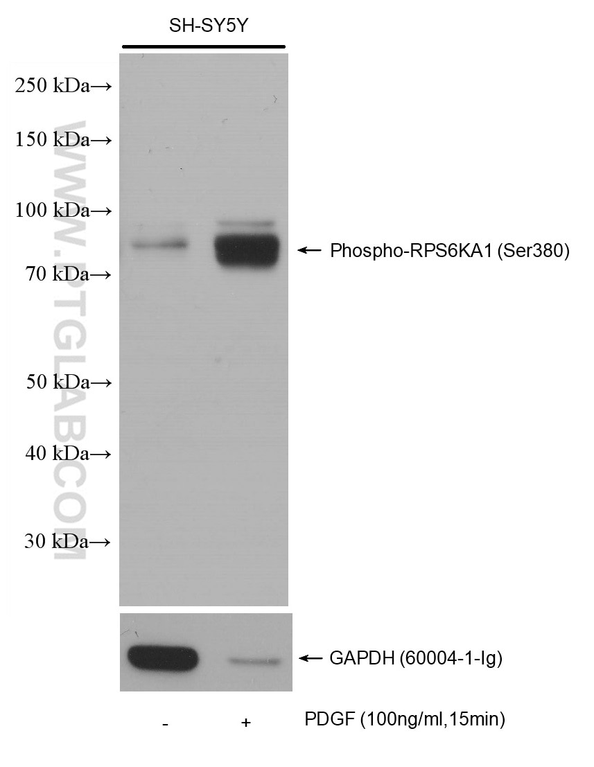 Phospho-RPS6KA1 (Ser380)