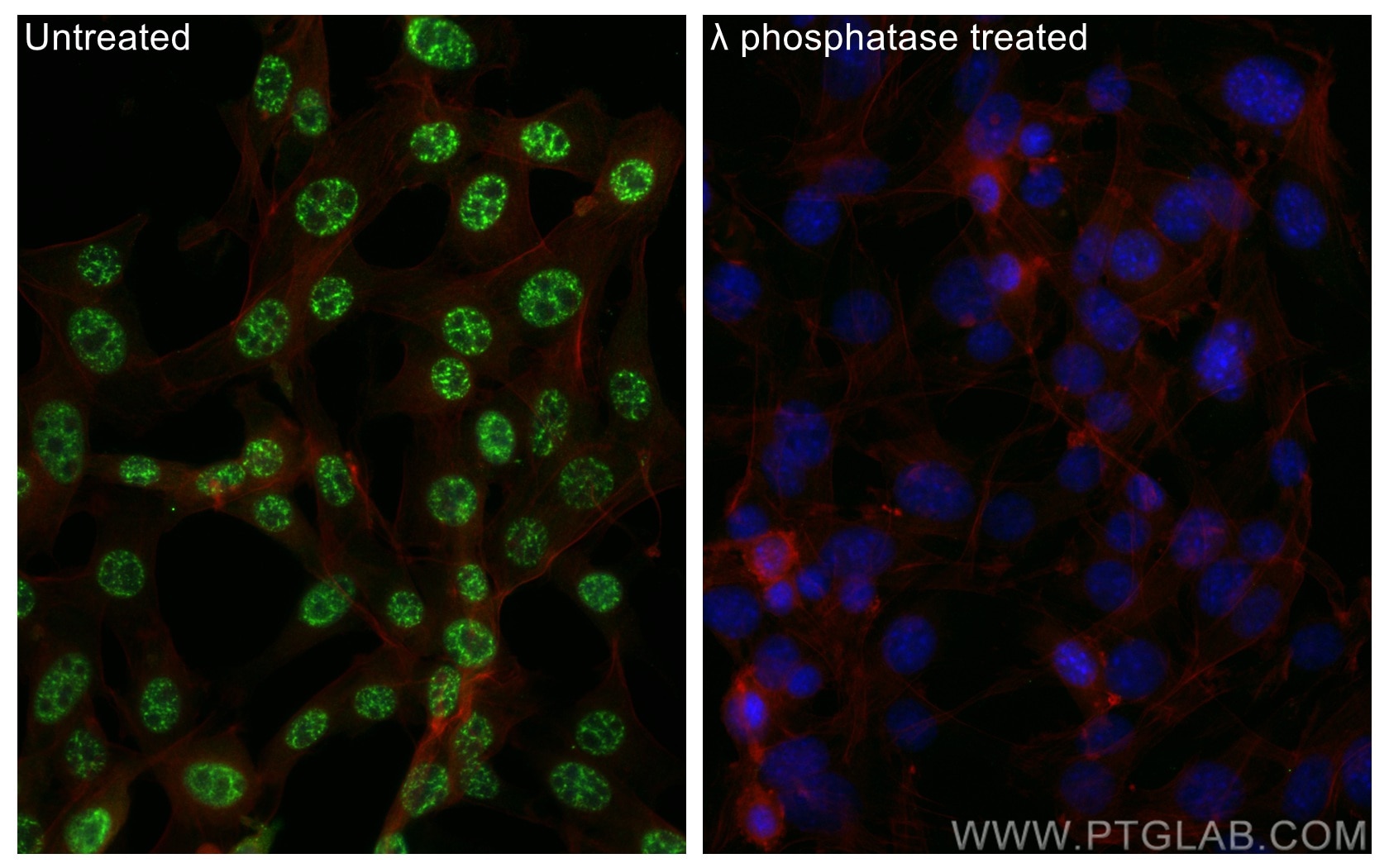 Immunofluorescence (IF) / fluorescent staining of NIH/3T3 cells using Phospho-RPS6KA1 (Thr359/Ser363) Polyclonal antibod (29225-1-AP)