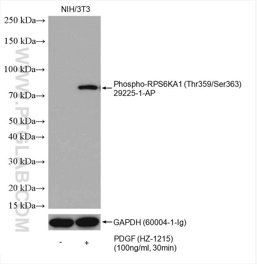 Western Blot (WB) analysis of various lysates using Phospho-RPS6KA1 (Thr359/Ser363) Polyclonal antibod (29225-1-AP)