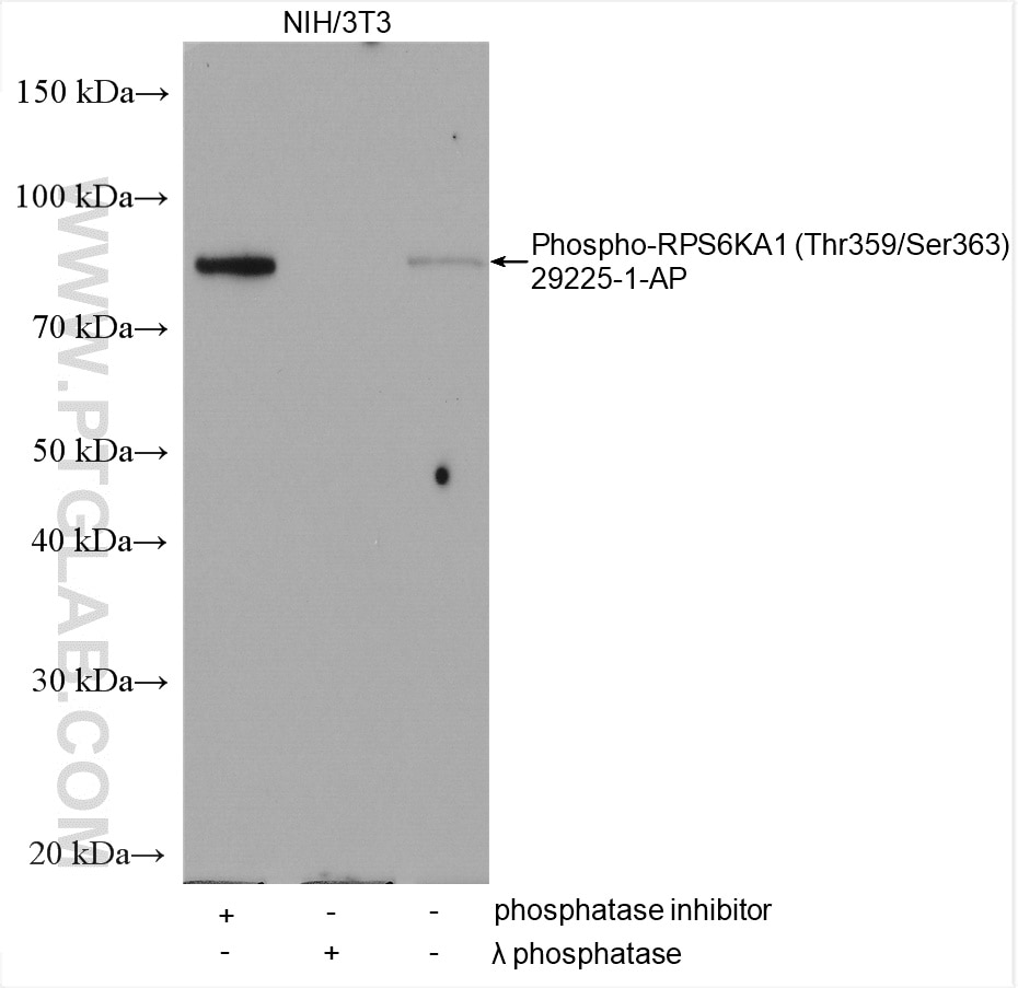 Western Blot (WB) analysis of various lysates using Phospho-RPS6KA1 (Thr359/Ser363) Polyclonal antibod (29225-1-AP)
