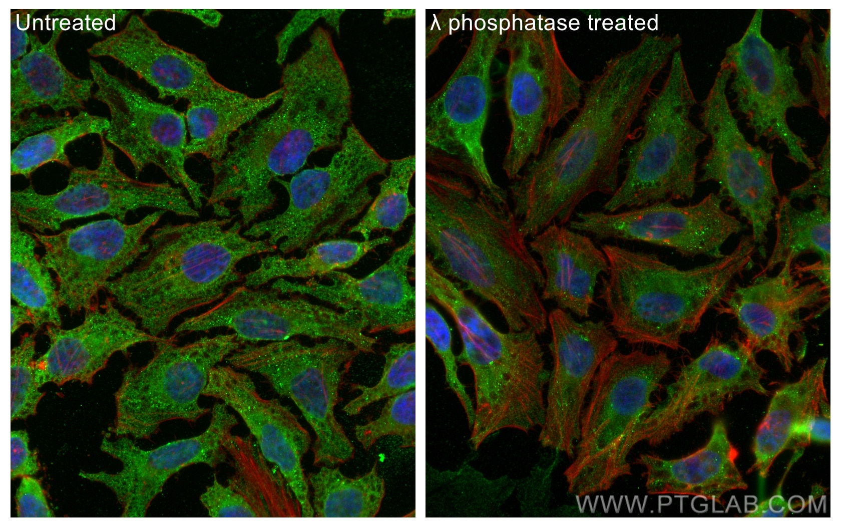 Immunofluorescence (IF) / fluorescent staining of HeLa cells using Phospho-RPS6KA1 (Thr359/Ser363) Monoclonal antibod (68041-1-Ig)