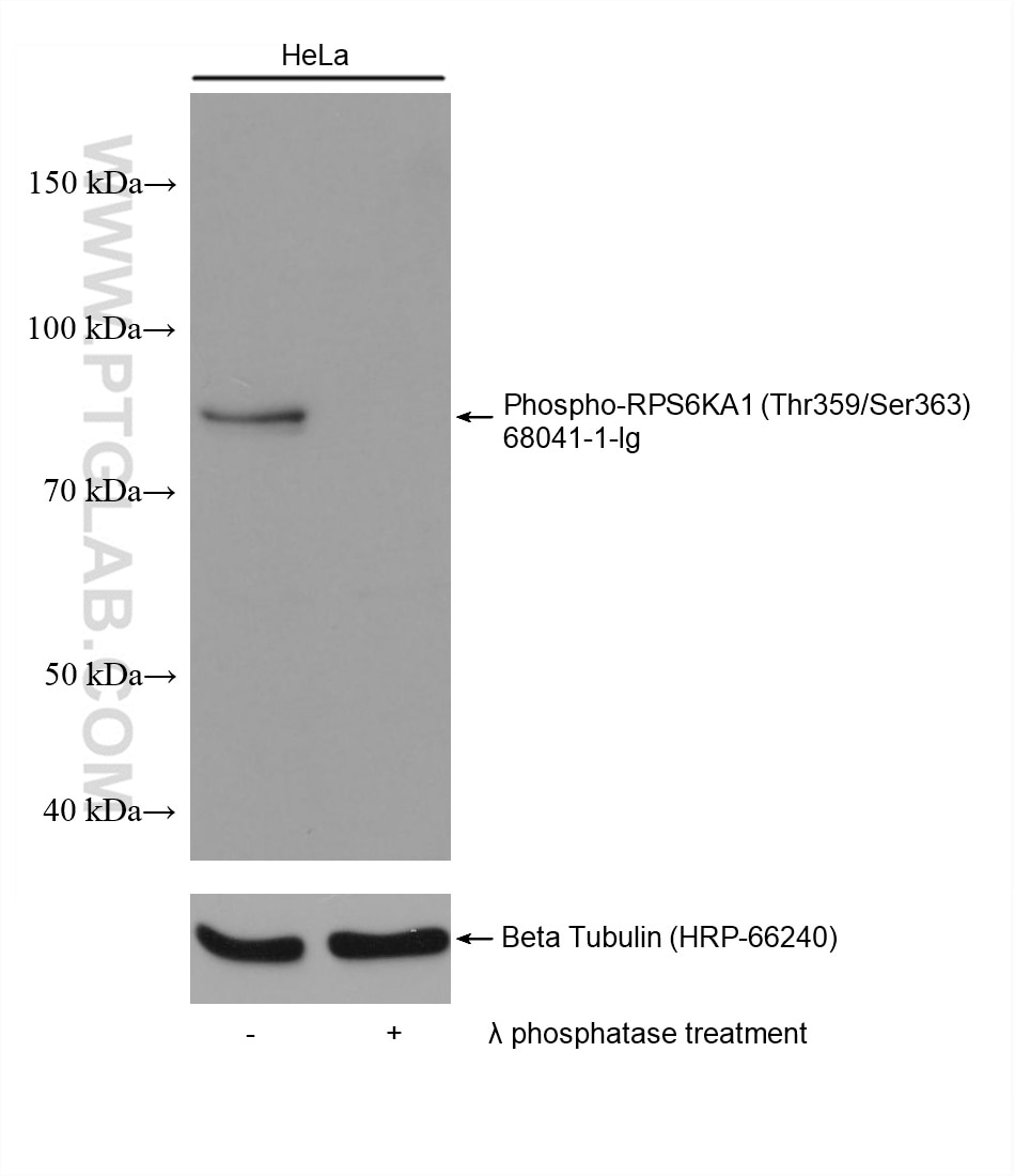 Western Blot (WB) analysis of various lysates using Phospho-RPS6KA1 (Thr359/Ser363) Monoclonal antibod (68041-1-Ig)