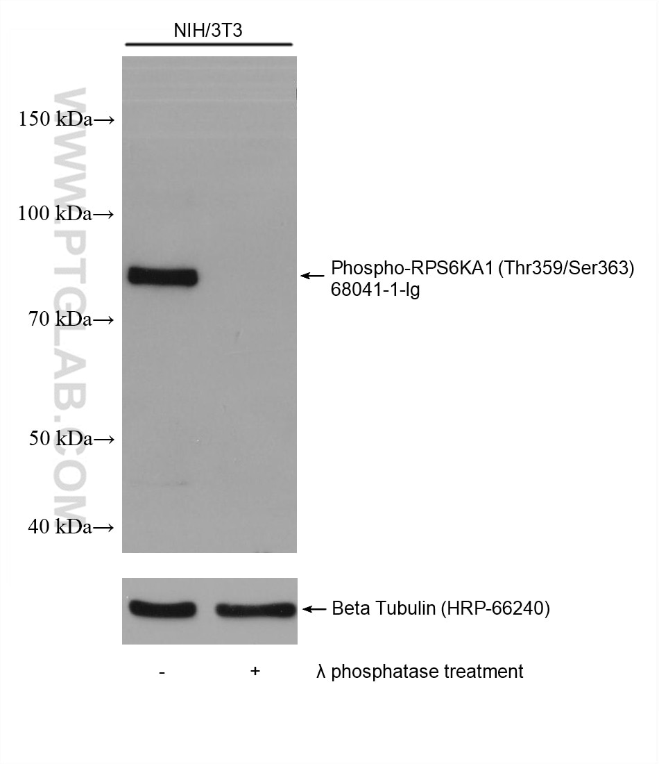 Western Blot (WB) analysis of various lysates using Phospho-RPS6KA1 (Thr359/Ser363) Monoclonal antibod (68041-1-Ig)