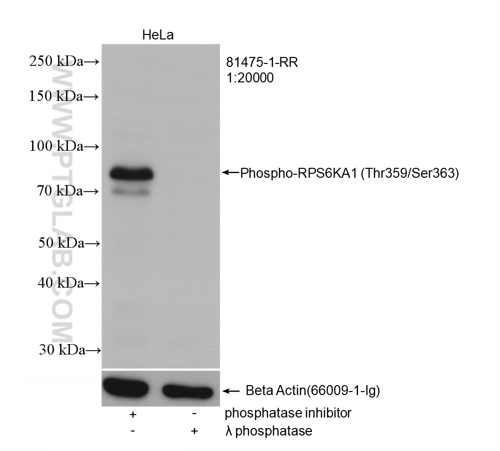 Western Blot (WB) analysis of HeLa cells using Phospho-RPS6KA1 (Thr359/Ser363) Recombinant antibo (81475-1-RR)