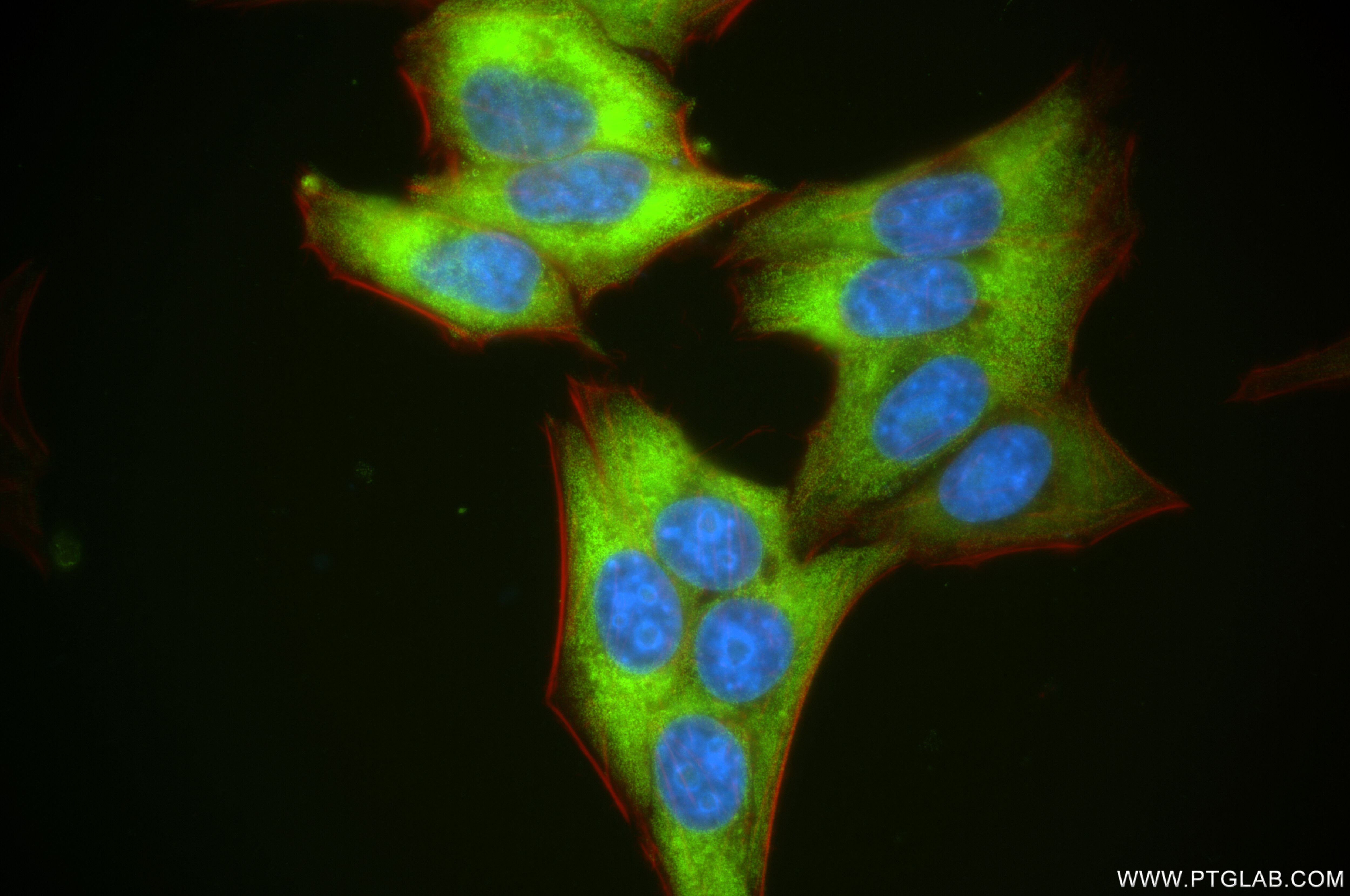 Phospho-S6 Ribosomal protein (Ser240/244)