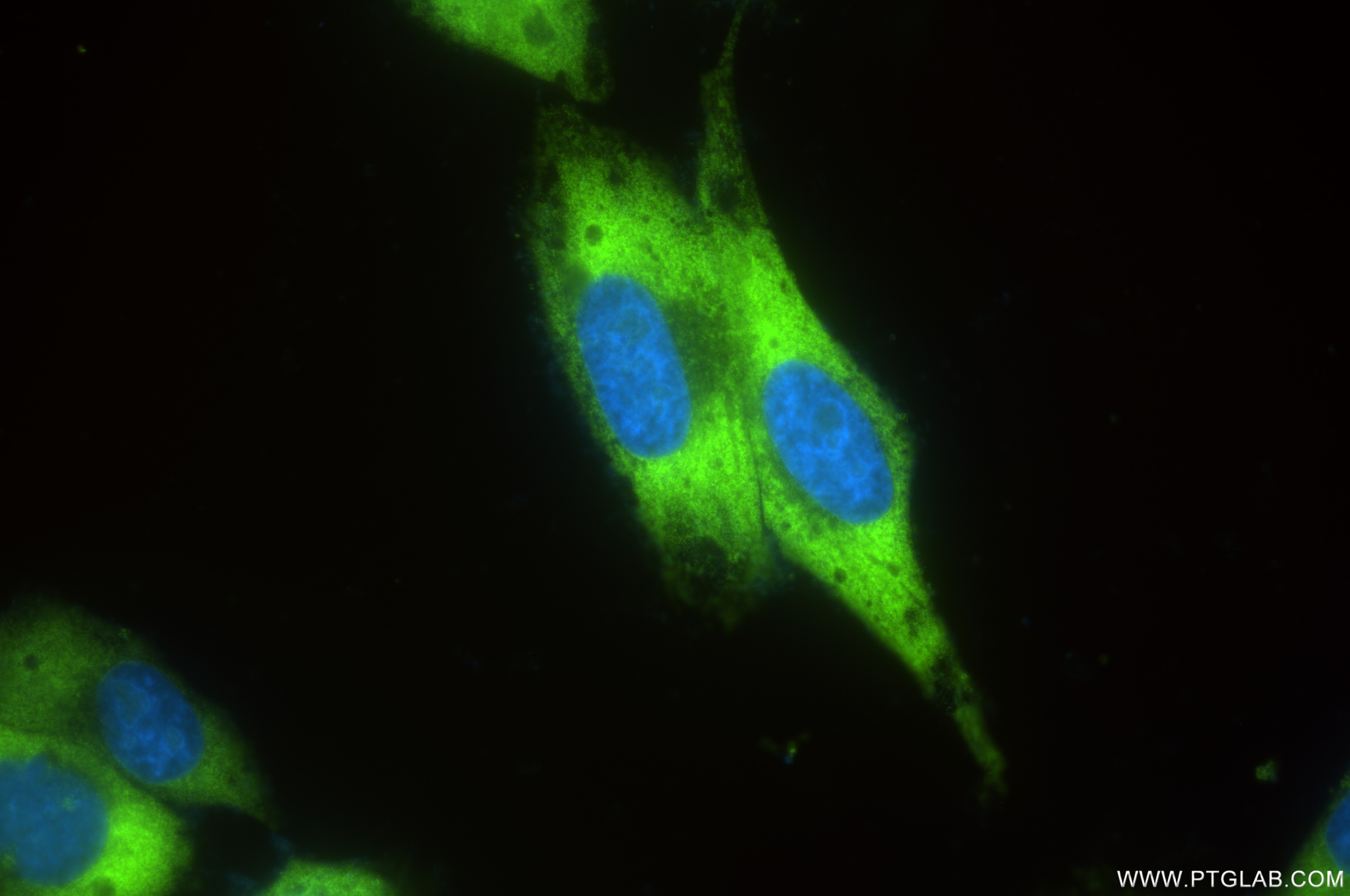 Immunofluorescence (IF) / fluorescent staining of HepG2 cells using Phospho-S6 Ribosomal protein (Ser240/244) Recombin (80575-3-RR)