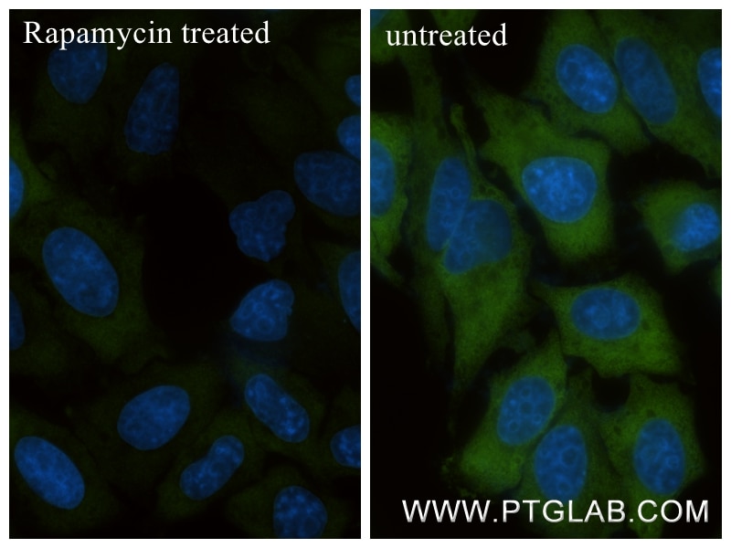 Immunofluorescence (IF) / fluorescent staining of HepG2 cells using Phospho-S6 Ribosomal protein (Ser240/244) Recombin (80575-3-RR)