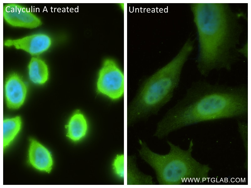 Immunofluorescence (IF) / fluorescent staining of HeLa cells using Phospho-S6 Ribosomal protein (Ser240/244) Recombin (81184-1-RR)