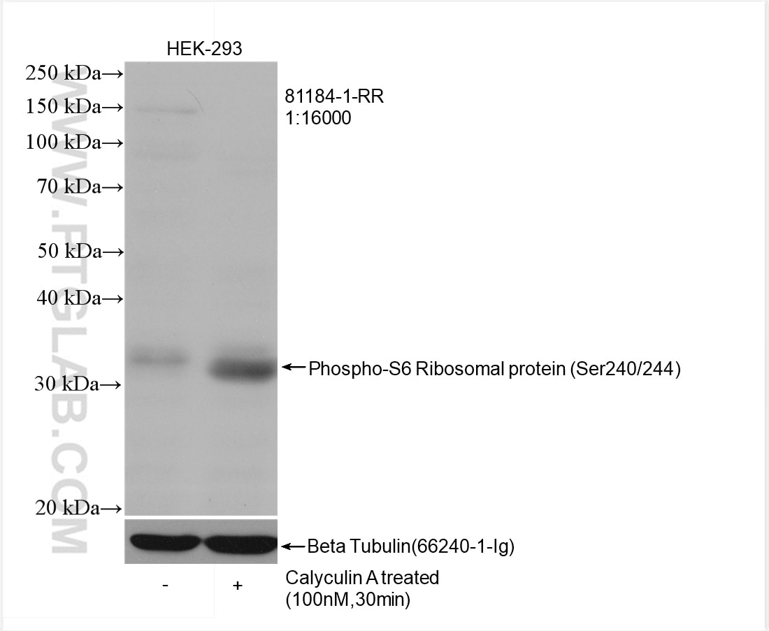 Western Blot (WB) analysis of HEK-293 cells using Phospho-S6 Ribosomal protein (Ser240/244) Recombin (81184-1-RR)