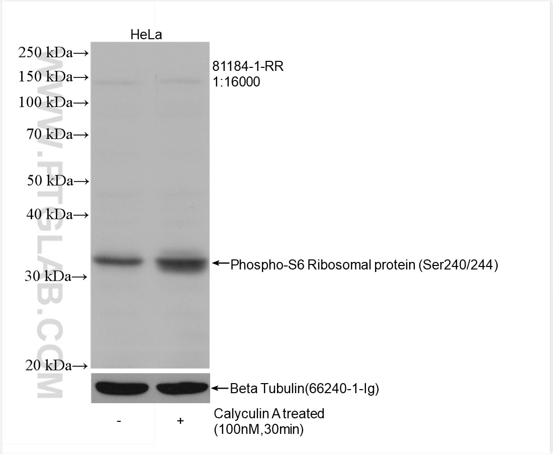 Western Blot (WB) analysis of HeLa cells using Phospho-S6 Ribosomal protein (Ser240/244) Recombin (81184-1-RR)