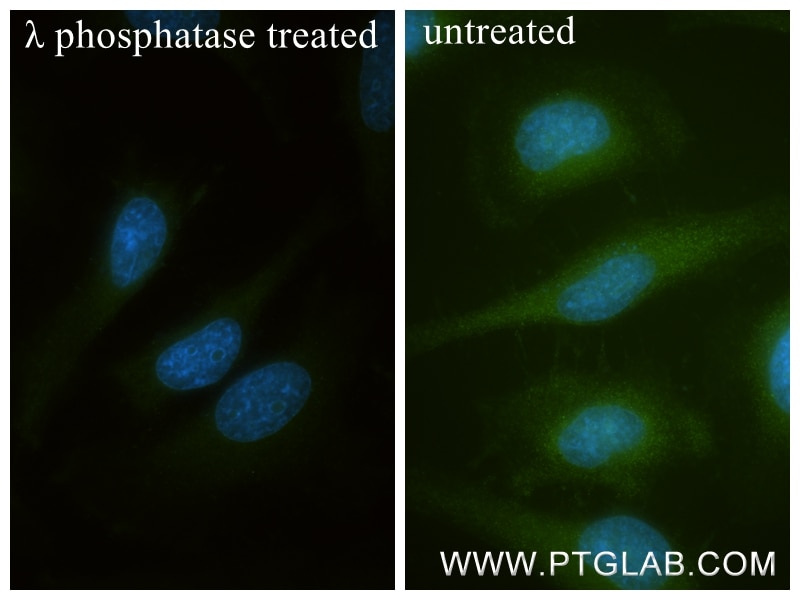 Immunofluorescence (IF) / fluorescent staining of HeLa cells using Phospho-SH3PXD2B (Ser291) Recombinant monoclonal a (84563-1-RR)