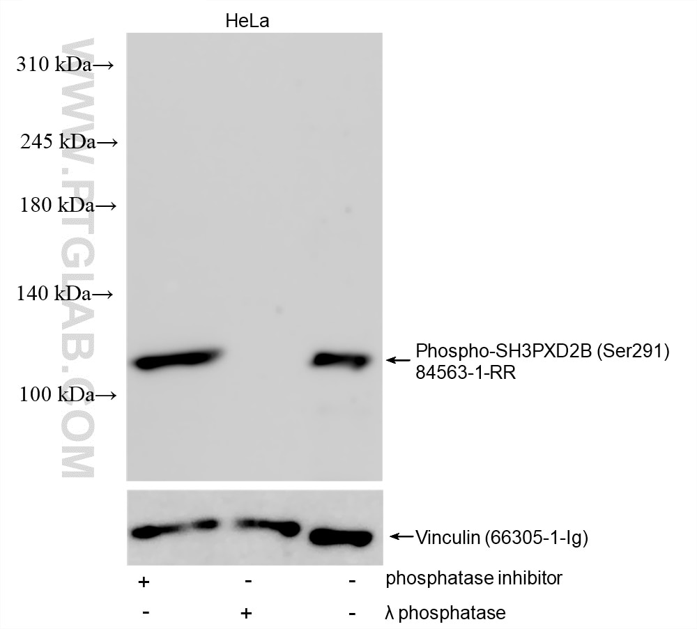 Phospho-SH3PXD2B (Ser291)
