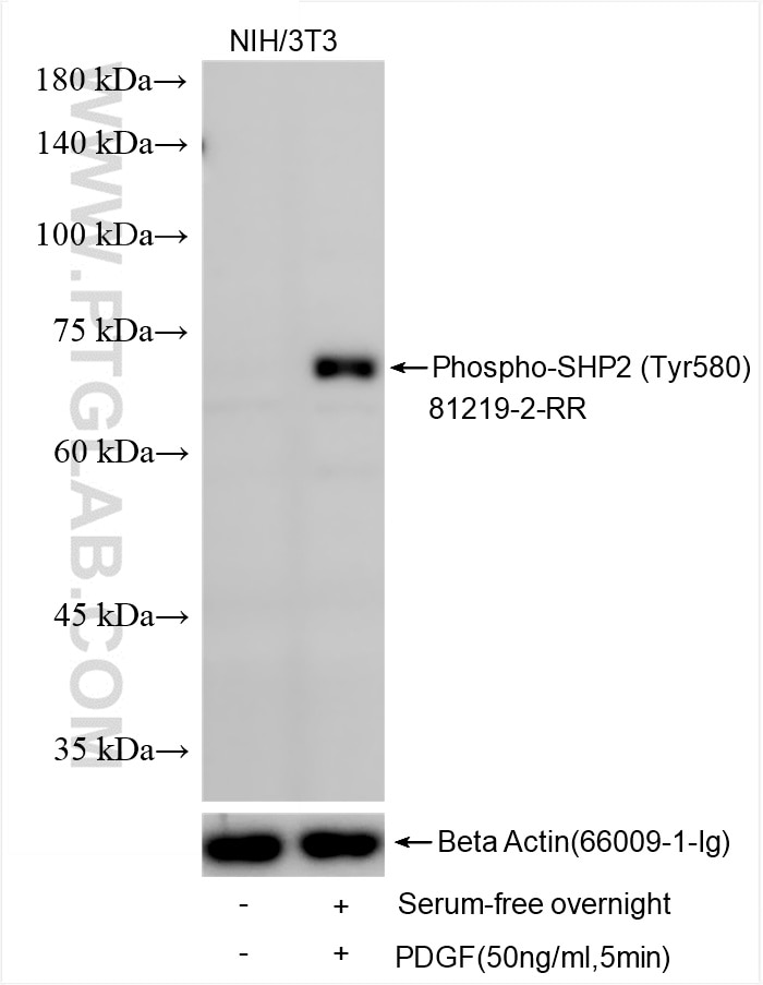 Western Blot (WB) analysis of various lysates using Phospho-SHP2 (Tyr580) Recombinant antibody (81219-2-RR)