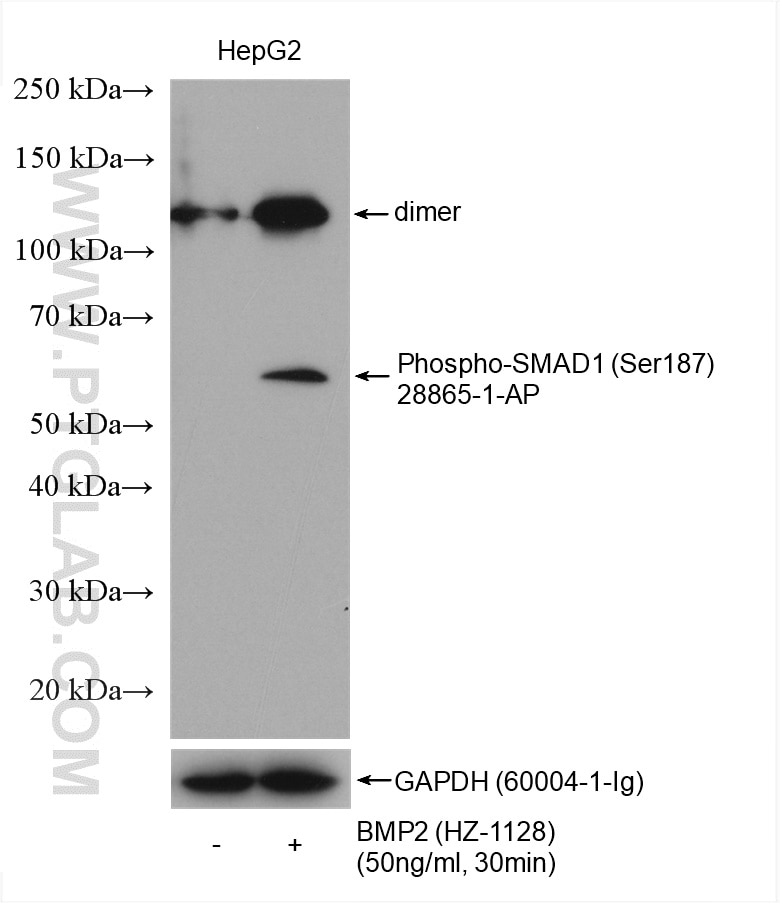 Western Blot (WB) analysis of various lysates using Phospho-SMAD1 (Ser187) Polyclonal antibody (28865-1-AP)
