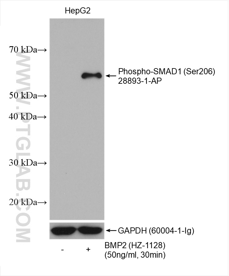 Western Blot (WB) analysis of various lysates using Phospho-SMAD1 (Ser206) Polyclonal antibody (28893-1-AP)