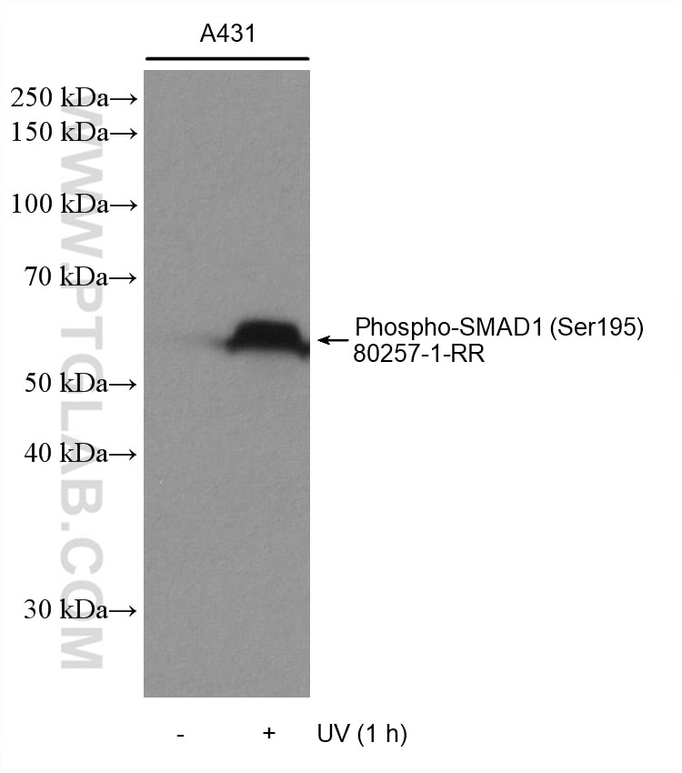 Western Blot (WB) analysis of various lysates using Phospho-SMAD1 (Ser195) Recombinant antibody (80257-1-RR)