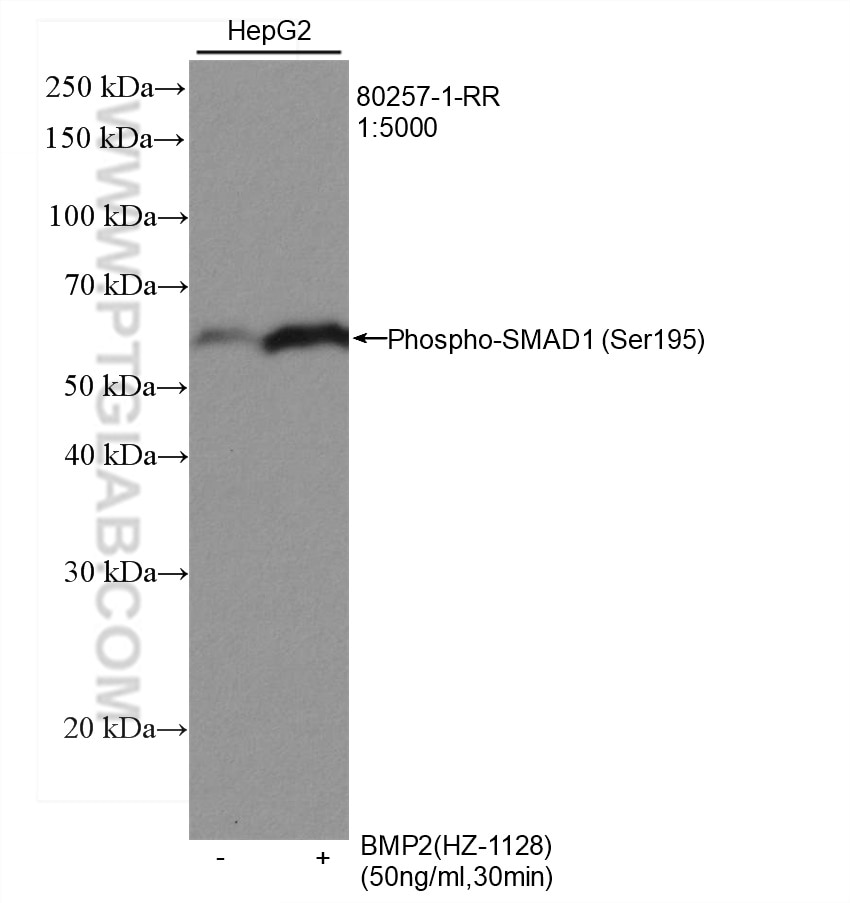 Western Blot (WB) analysis of various lysates using Phospho-SMAD1 (Ser195) Recombinant antibody (80257-1-RR)