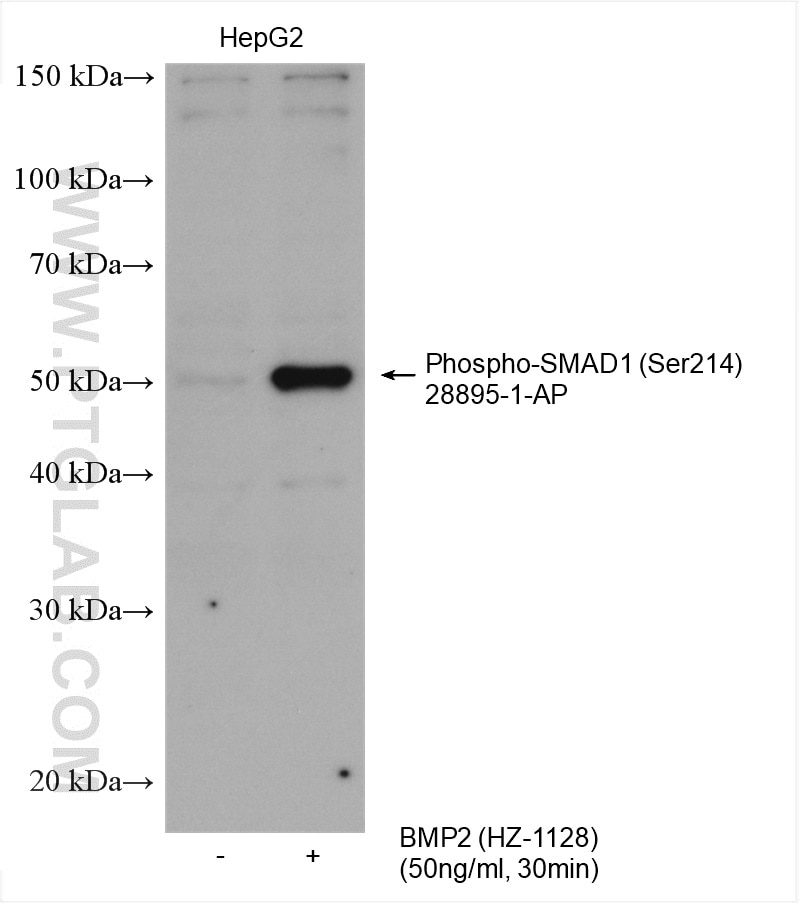 Western Blot (WB) analysis of various lysates using Phospho-SMAD1 (Ser214) Polyclonal antibody (28895-1-AP)