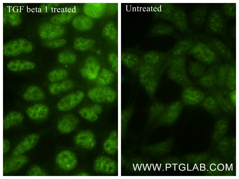 Phospho-SMAD2 (Ser465/467)/SMAD3 (Ser423/425)
