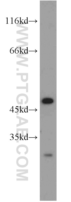 Western Blot (WB) analysis of L02 cells using Phospho-SPHK1 (Ser225) Polyclonal antibody (19561-1-AP)