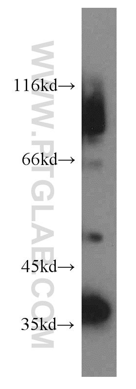 Western Blot (WB) analysis of human testis tissue using Phospho-SPHK1 (Ser225) Polyclonal antibody (19561-1-AP)