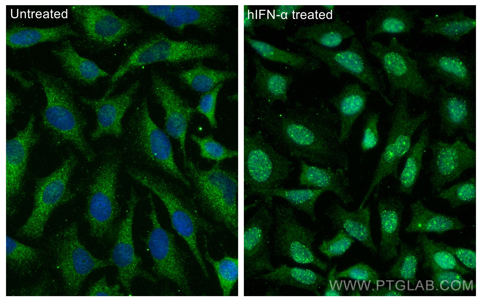 Immunofluorescence (IF) / fluorescent staining of HeLa cells using Phospho-STAT1 (Ser727) Polyclonal antibody (28977-1-AP)