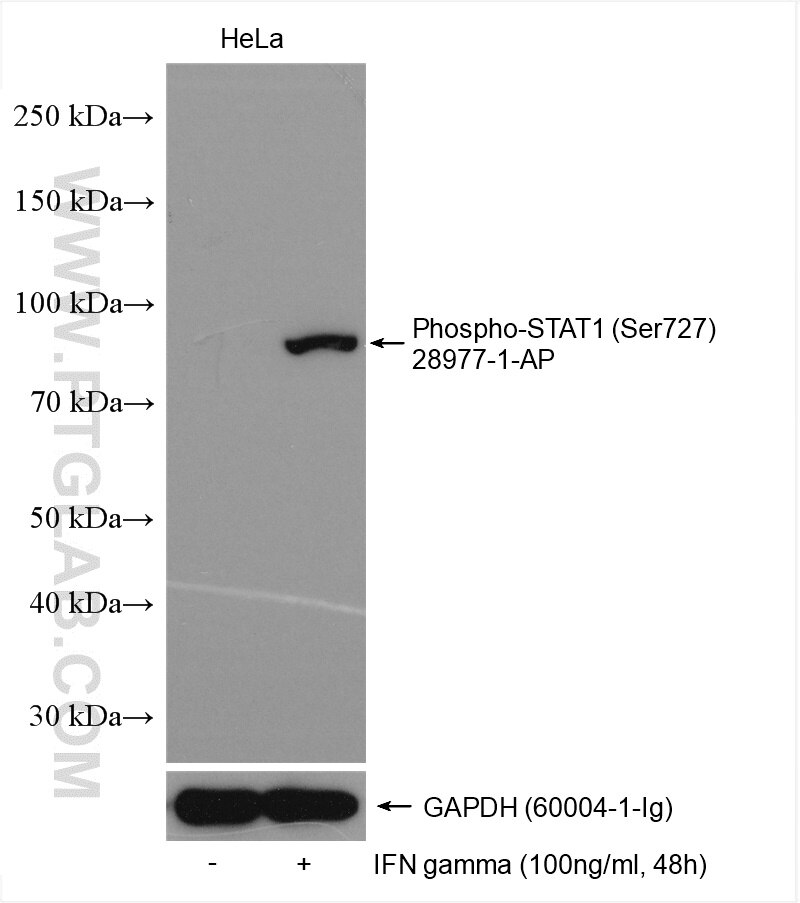 Western Blot (WB) analysis of various lysates using Phospho-STAT1 (Ser727) Polyclonal antibody (28977-1-AP)
