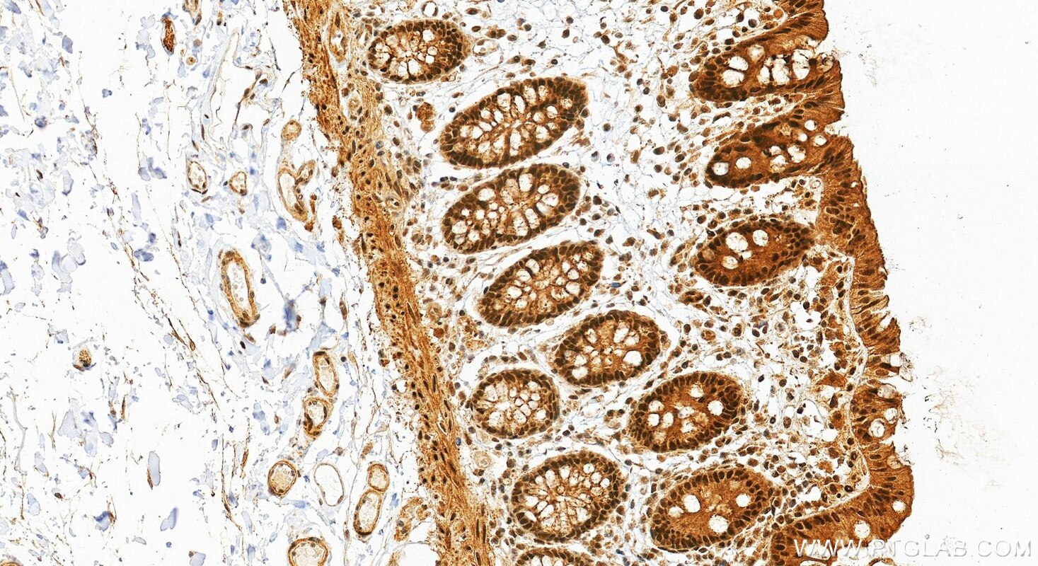 Immunohistochemistry (IHC) staining of human colon tissue using Phospho-STAT1 (Ser727) Recombinant monoclonal anti (80683-7-RR)