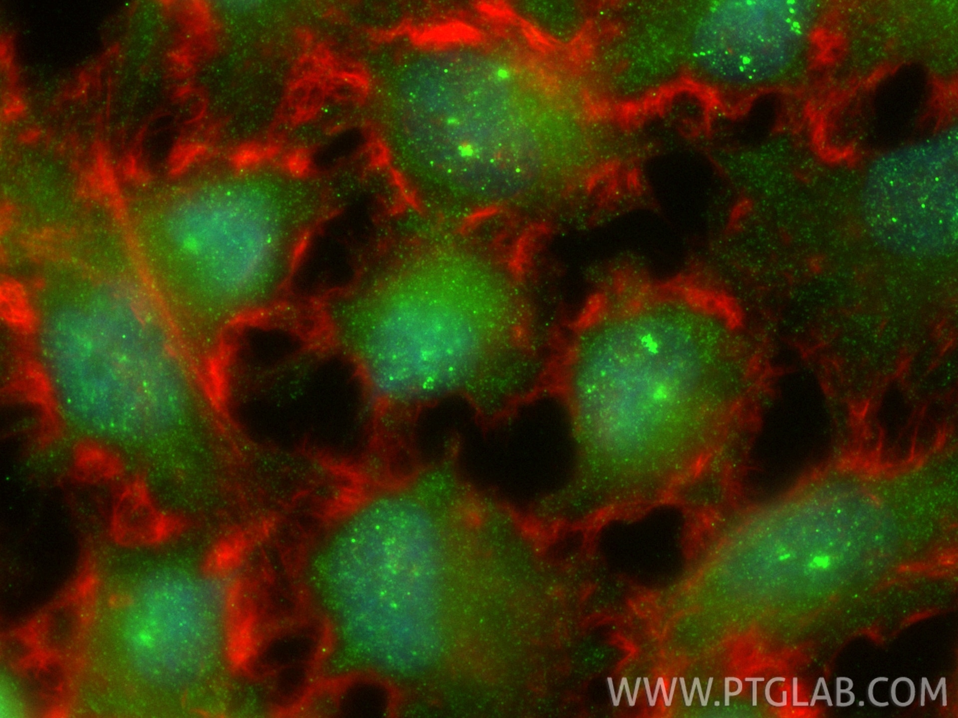 IF Staining of U-251 using 80683-7-RR (same clone as 80683-7-PBS) Immunofluorescence (IF) / fluorescent staining of U-251 cells using Phospho-STAT1 (Ser727) Recombinant monoclonal anti (80683-7-RR)