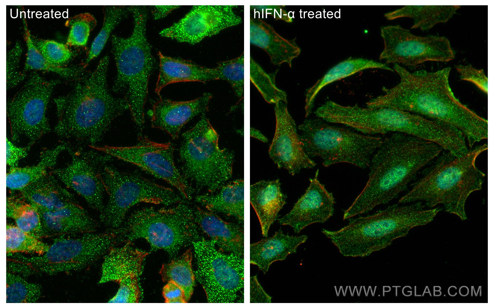 Immunofluorescence (IF) / fluorescent staining of HeLa cells using Phospho-STAT1 (Tyr701) Polyclonal antibody (28979-1-AP)