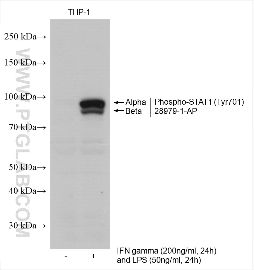 Western Blot (WB) analysis of various lysates using Phospho-STAT1 (Tyr701) Polyclonal antibody (28979-1-AP)
