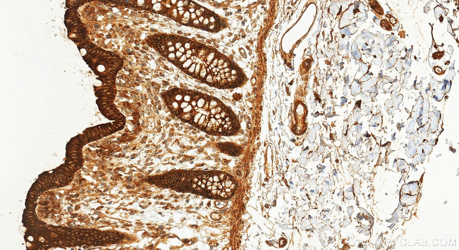 Immunohistochemistry (IHC) staining of human colon tissue using Phospho-STAT1 (Tyr701) Recombinant monoclonal anti (82674-10-RR)