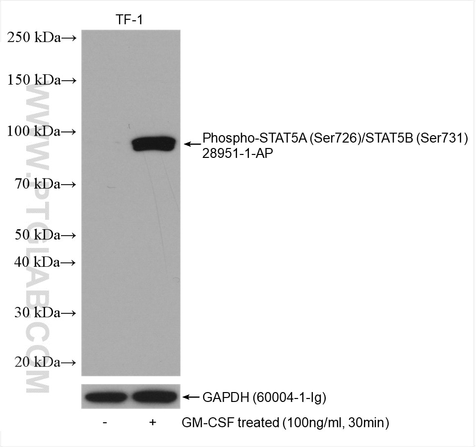 Western Blot (WB) analysis of various lysates using Phospho-STAT5A(Ser726)/STAT5B (Ser731) Polyclonal  (28951-1-AP)