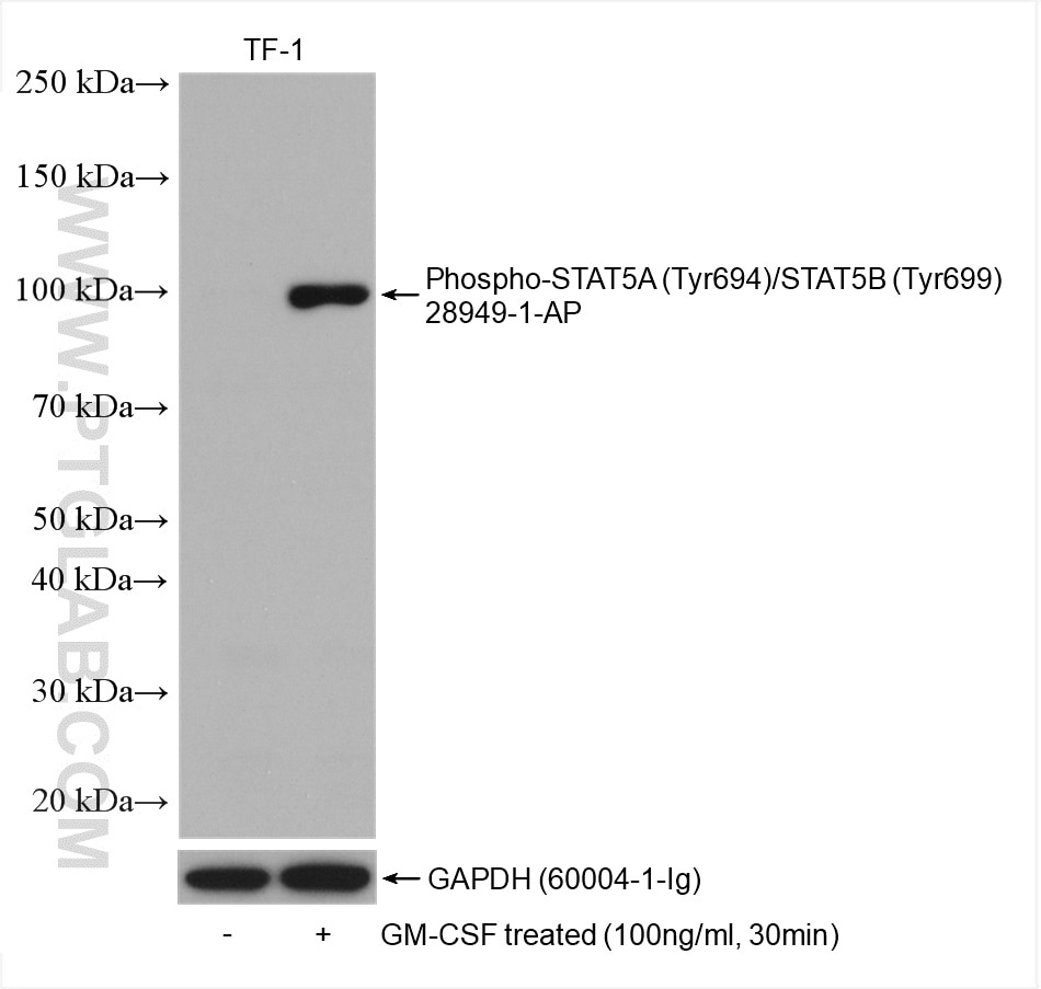 Western Blot (WB) analysis of various lysates using Phospho-STAT5A (Tyr694)/STAT5B (Tyr699) Polyclonal (28949-1-AP)