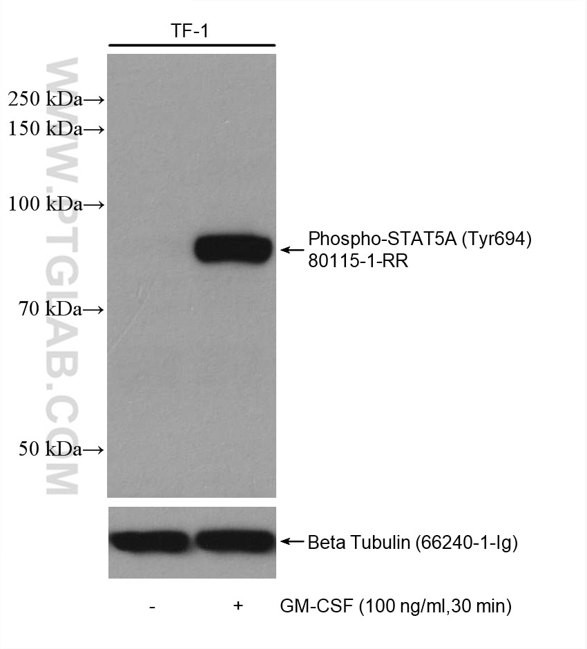 Phospho-STAT5A (Tyr694)