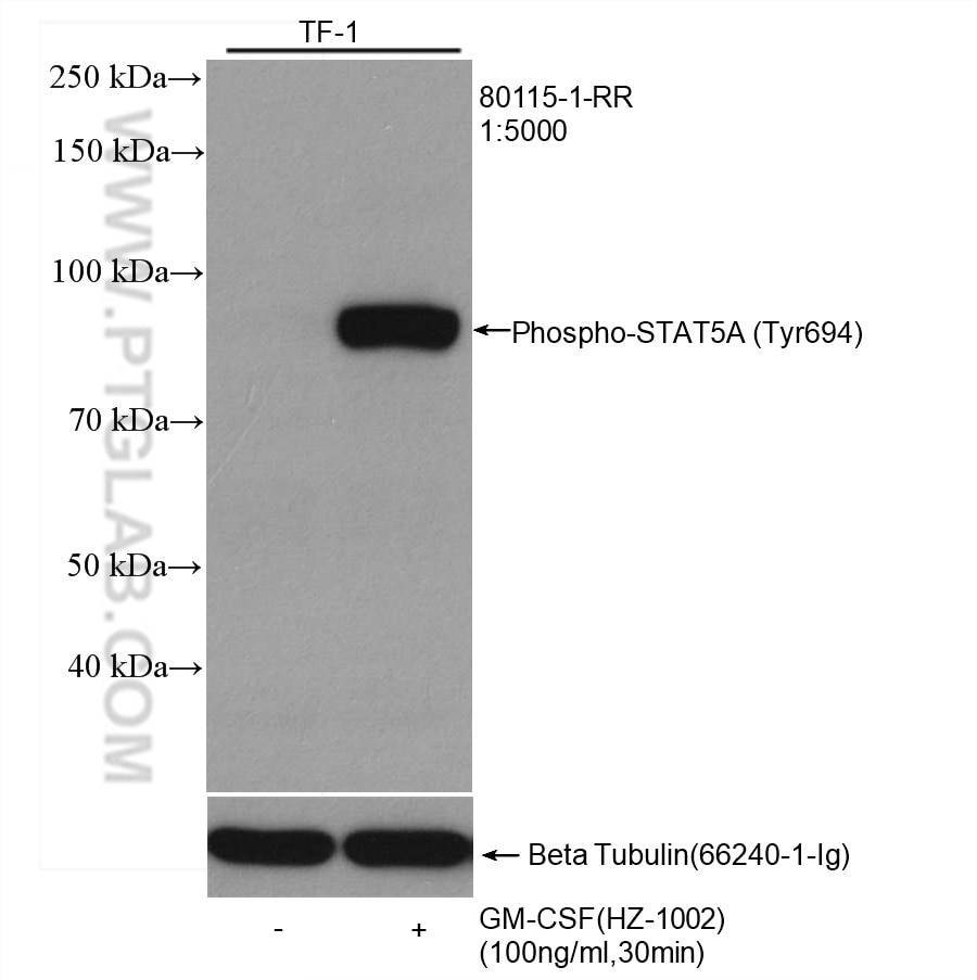 Western Blot (WB) analysis of various lysates using Phospho-STAT5A (Tyr694) Recombinant antibody (80115-1-RR)