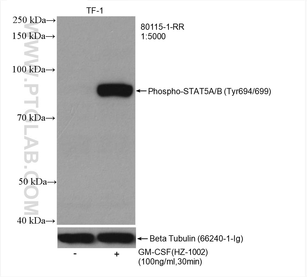 Western Blot (WB) analysis of various lysates using Phospho-STAT5A (Tyr694) Recombinant antibody (80115-1-RR)