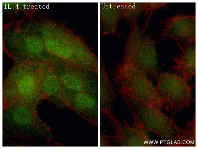IF Staining of ACHN using 86641-1-RR Immunofluorescence (IF) / fluorescent staining of ACHN cells using Phospho-STAT6 (Tyr641) Recombinant monoclonal anti (86641-1-RR)