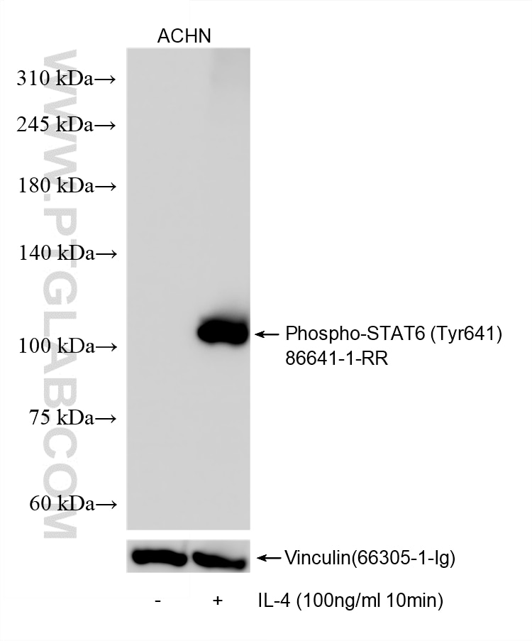 Non-treated ACHN cells and IL-4 (HZ-1004) treated ACHN cells were subjected to SDS PAGE followed by western blot with 86641-1-RR (Phospho-STAT6 (Tyr641) antibody) at dilution of 1:10000 incubated at room temperature for 1.5 hours. The membrane was stripped and re-blotted with Vinculin (66305-1-Ig) antibody as a loading control. This data was developed using the same antibody clone with 86641-1-PBS in a different storage buffer formulation. Western Blot (WB) analysis of various lysates using Phospho-STAT6 (Tyr641) Recombinant monoclonal anti (86641-1-RR)