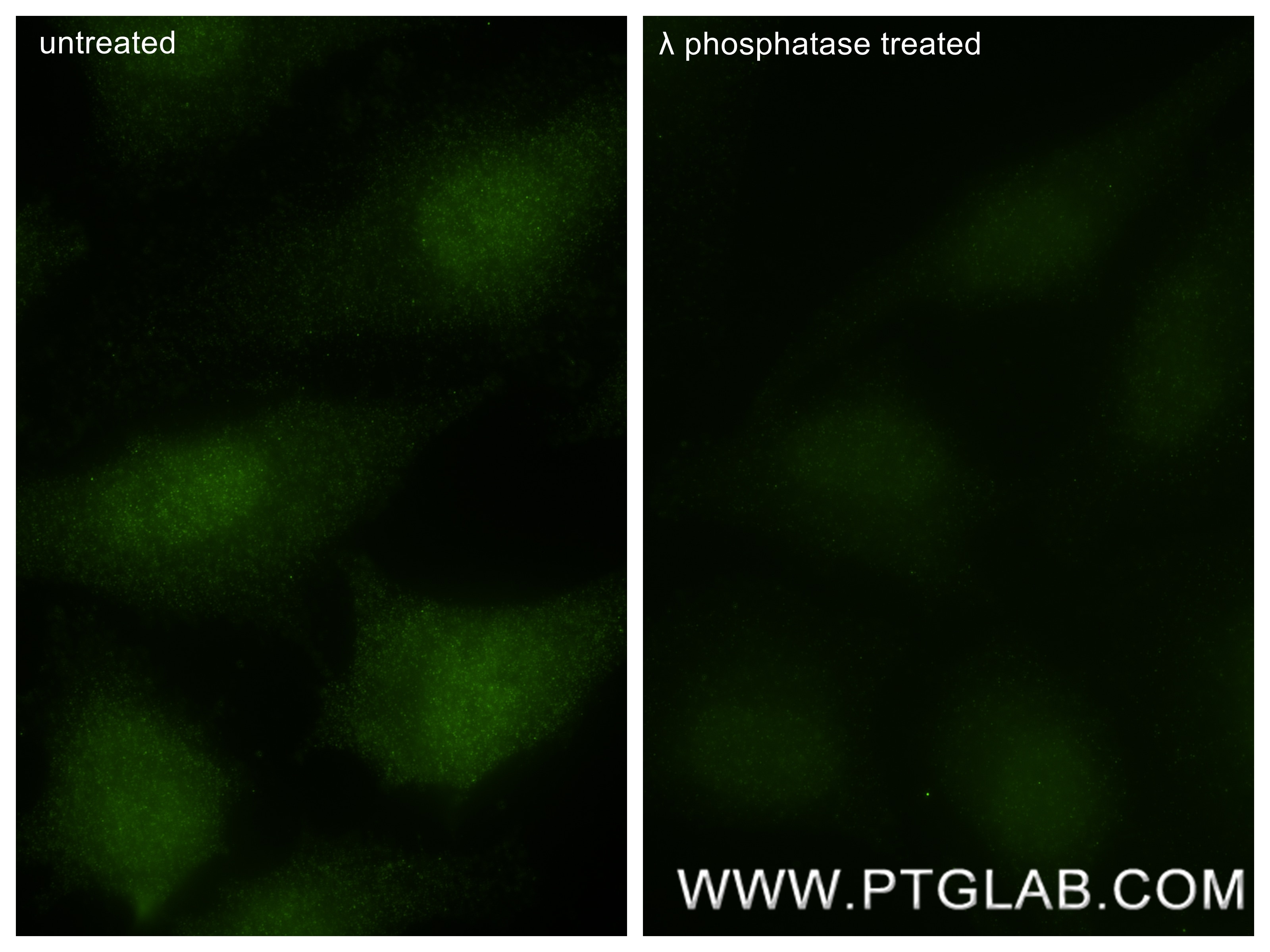 IF Staining of HeLa using 87893-2-RR Immunofluorescence (IF) / fluorescent staining of HeLa cells using Phospho-STK11/LKB1 (Ser334) Recombinant monoclonal (87893-2-RR)