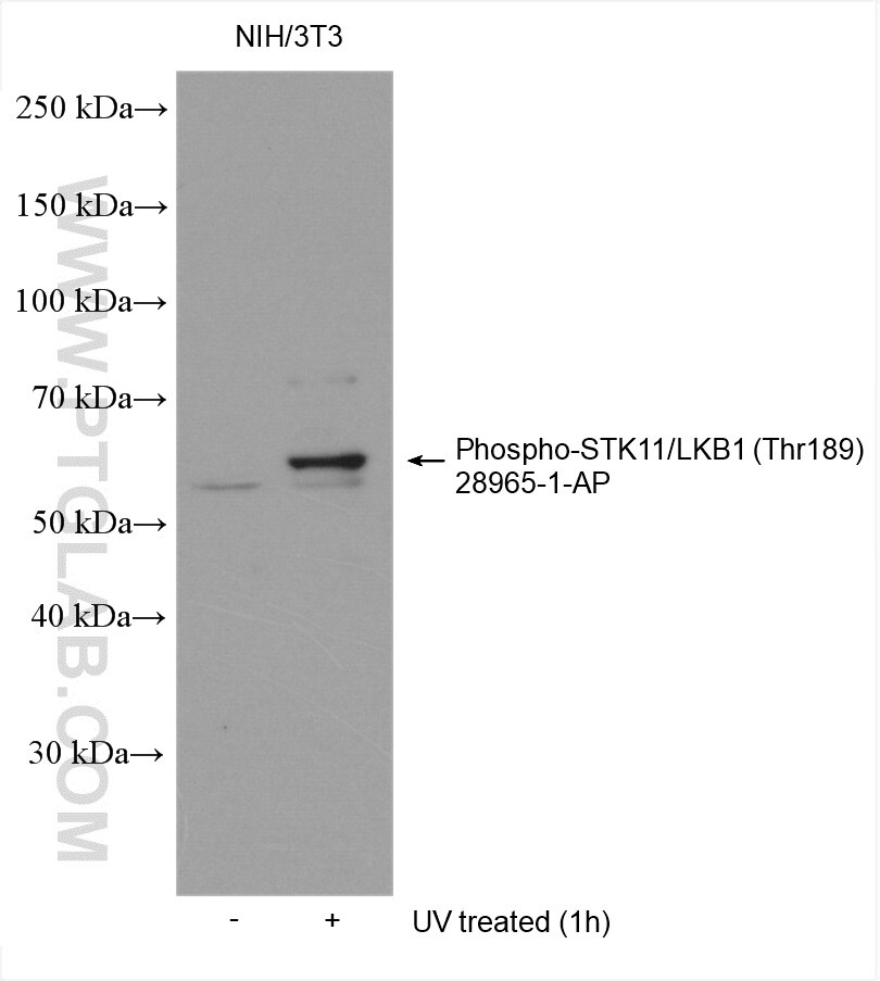 Western Blot (WB) analysis of various lysates using Phospho-STK11/LKB1 (Thr189) Polyclonal antibody (28965-1-AP)