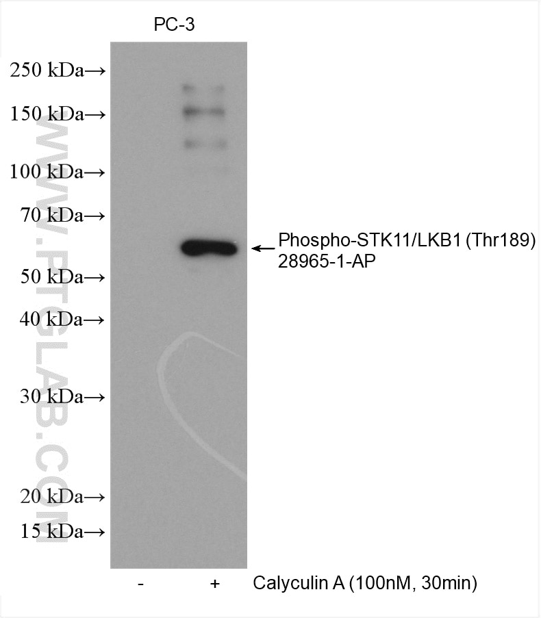 Western Blot (WB) analysis of various lysates using Phospho-STK11/LKB1 (Thr189) Polyclonal antibody (28965-1-AP)