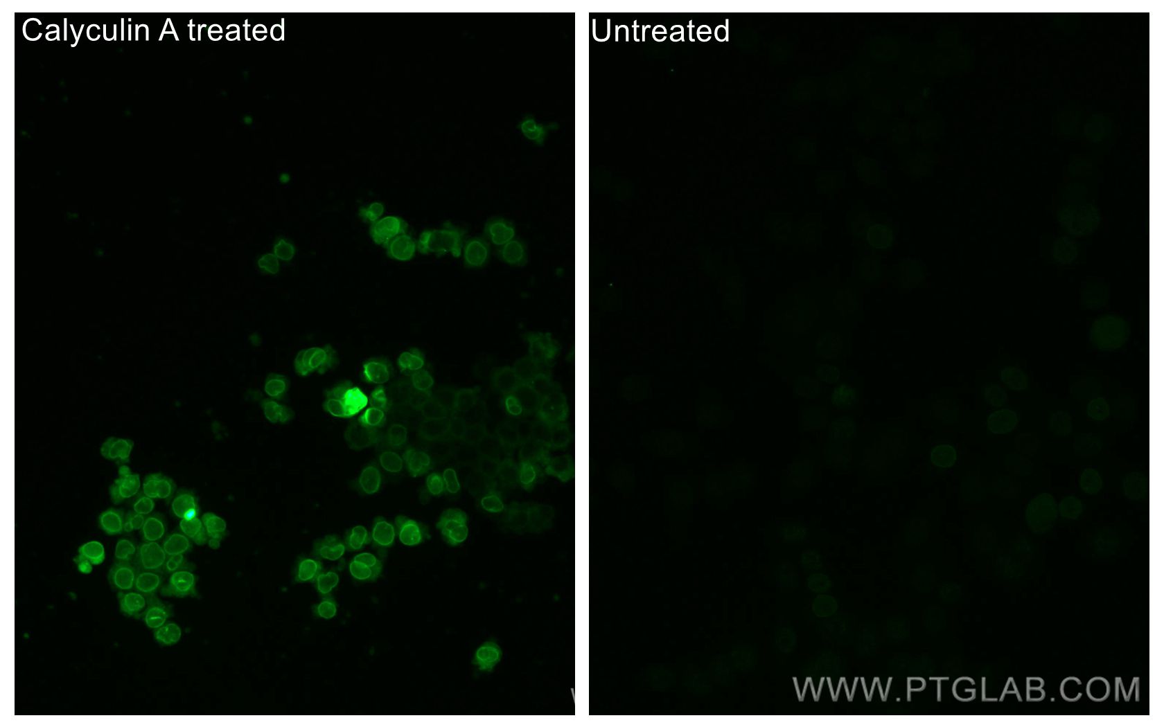 Immunofluorescence (IF) / fluorescent staining of PC-3 cells using Phospho-STK11/LKB1 (Thr189) Recombinant antibody (80127-1-RR)