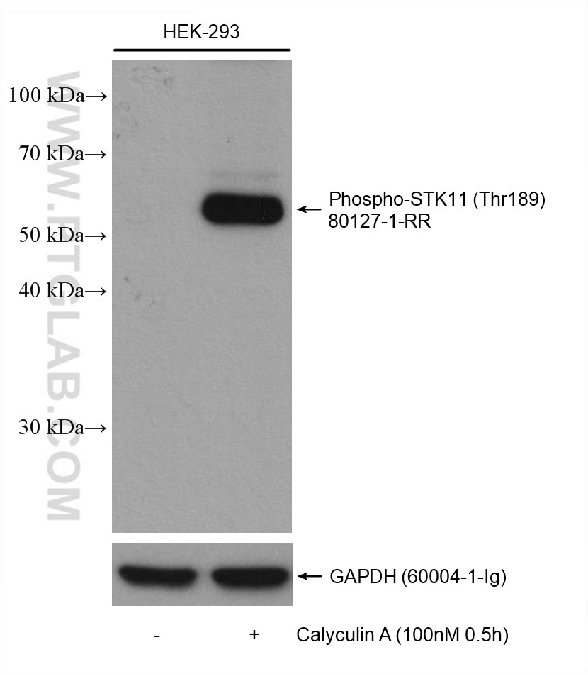 Western Blot (WB) analysis of various lysates using Phospho-STK11/LKB1 (Thr189) Recombinant antibody (80127-1-RR)