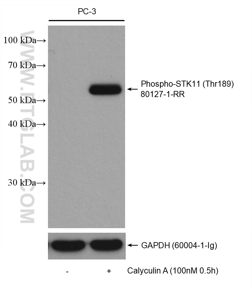 Western Blot (WB) analysis of various lysates using Phospho-STK11/LKB1 (Thr189) Recombinant antibody (80127-1-RR)