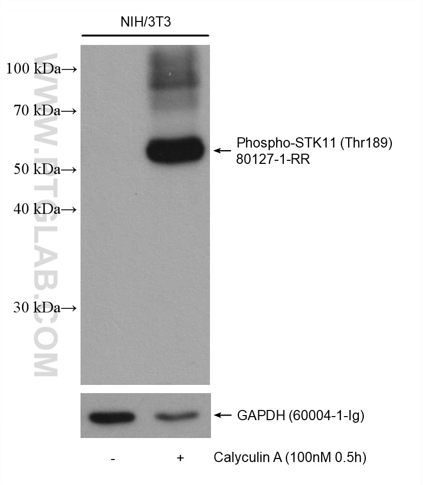 Western Blot (WB) analysis of various lysates using Phospho-STK11/LKB1 (Thr189) Recombinant antibody (80127-1-RR)