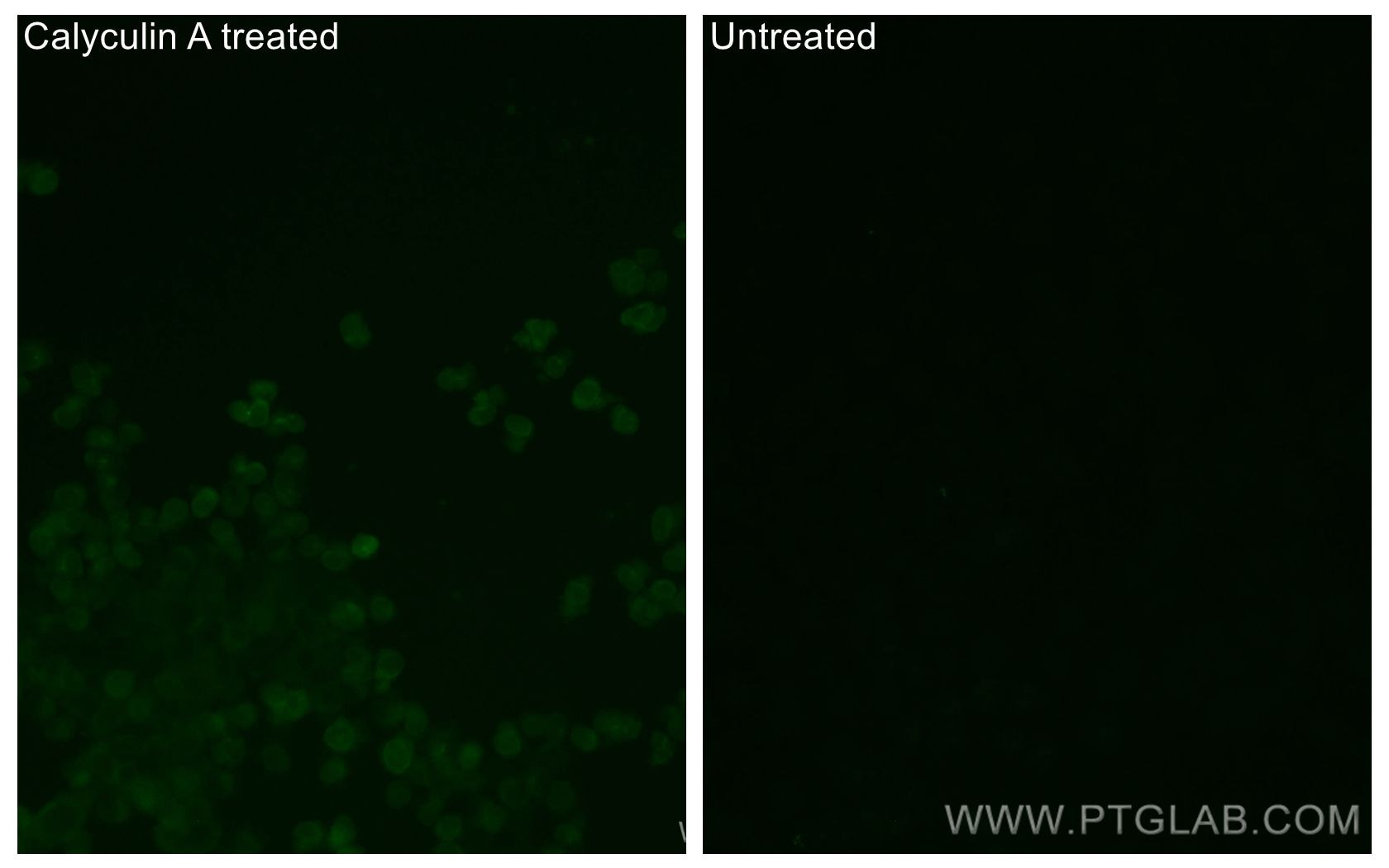 IF Staining of PC-3 using CL488-80127