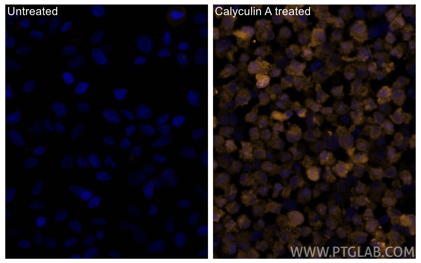 Immunofluorescence (IF) / fluorescent staining of HeLa cells using CoraLite®555-conjugated Phospho-STK11/LKB1 (Thr189 (CL555-80127)